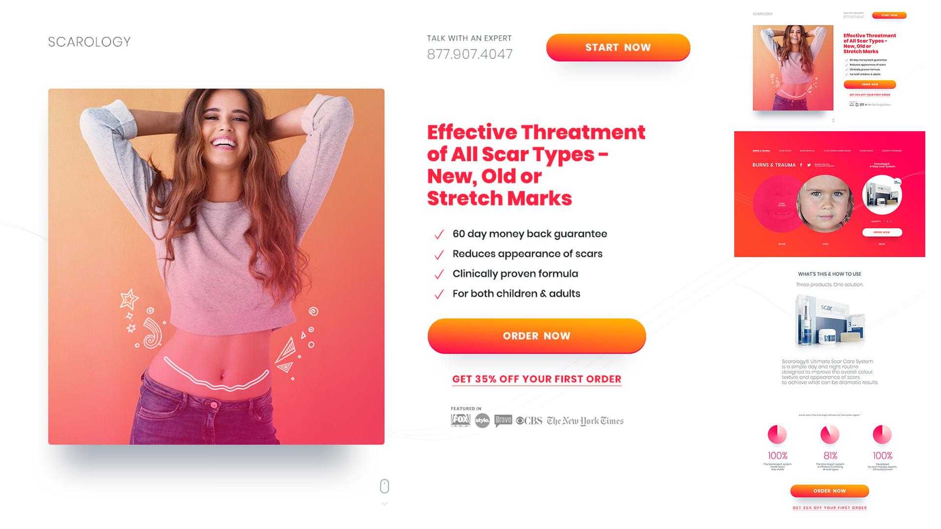 Variant of the scar treatment landing page: headline about effective treatment of all scar types, order now button and trust badges
